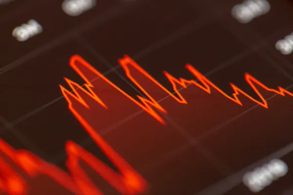 Financial charts for economy study